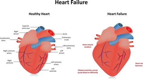 lv meaning medical.